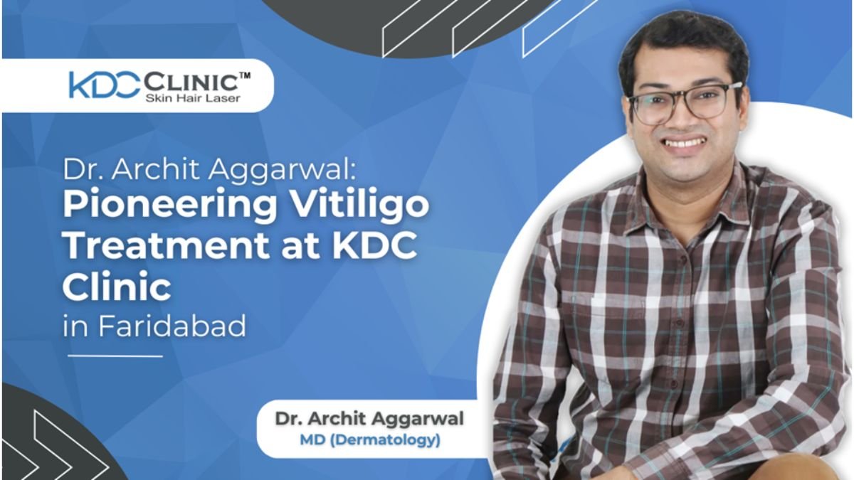 Dr. Archit Aggarwal: Pioneering Vitiligo Treatment at KDC Clinic in Faridabad